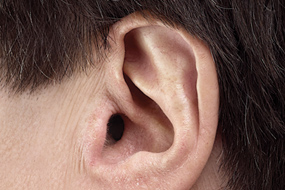 SONIC IIC Hidden invisible hearing aids custom hearing aids