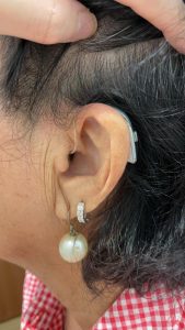 rechargeable hearing aids singapore on ear