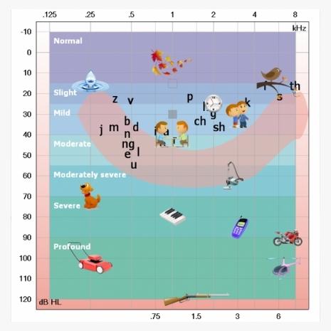 hearing test singapore audiogram